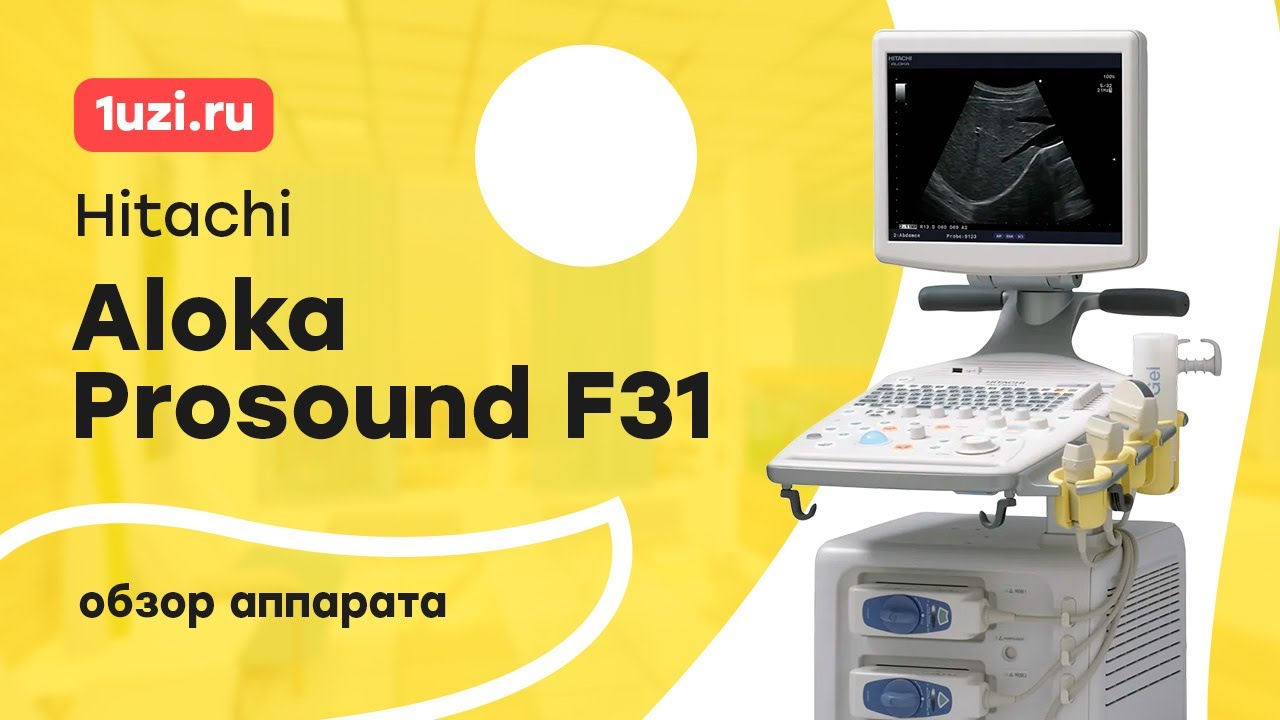 Обзор УЗИ аппарата Hitachi Aloka Prosound F31