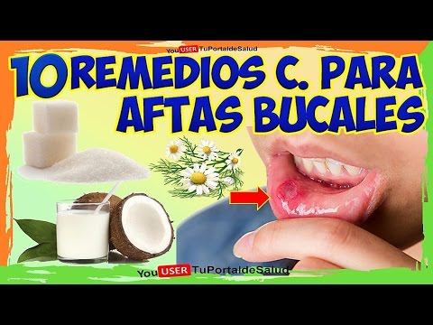 10 Remedios Caseros para las llagas en la Boca - Aftas Bucales Tratamientos Naturales