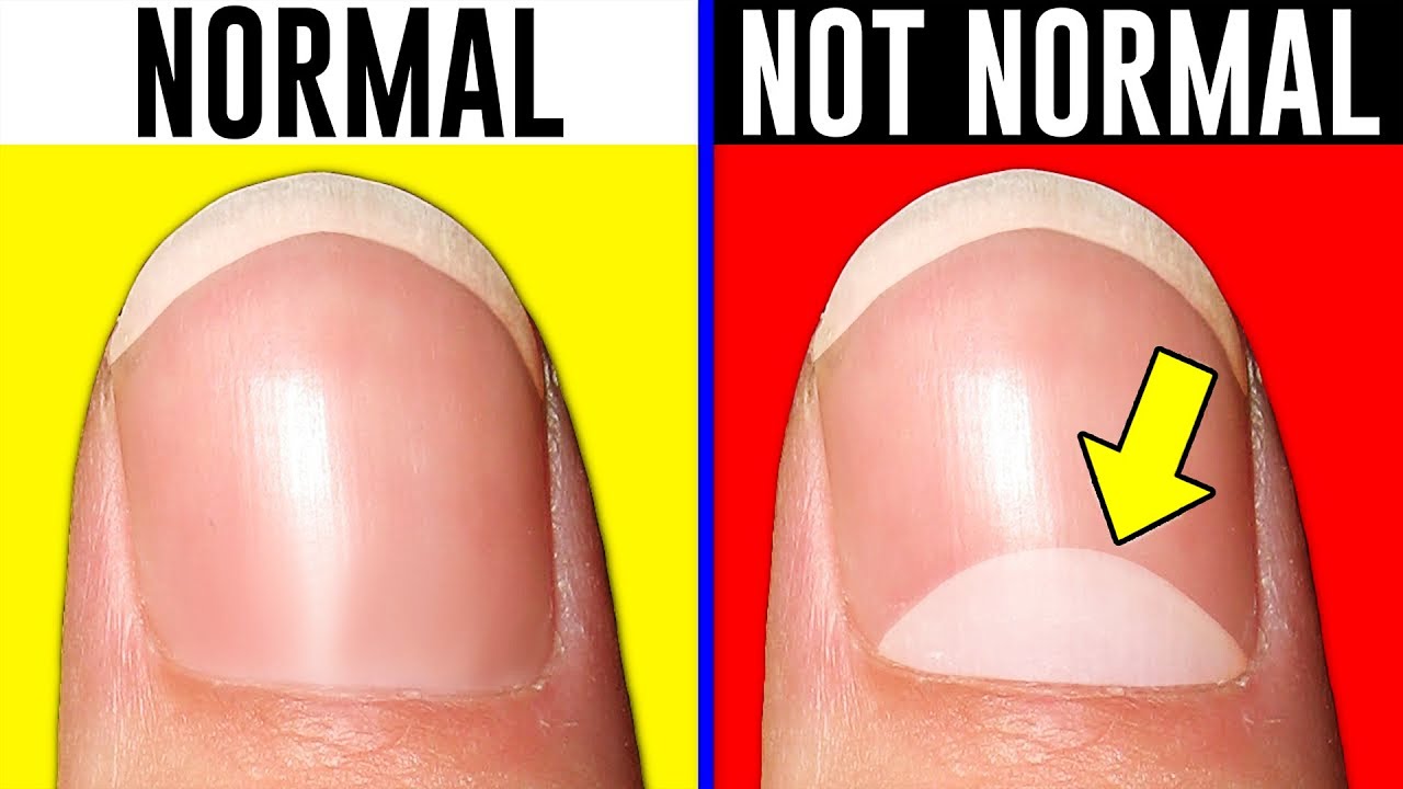 10 Signs You're Actually Normal..