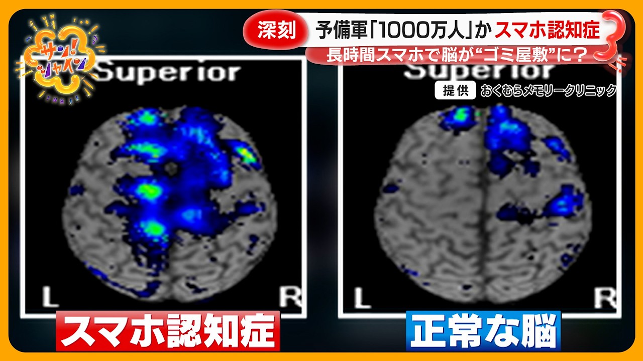 【深刻】予備軍1000万人？｢スマホ認知症｣とは…長時間利用で脳が“ゴミ屋敷”に【サン！シャインニュース】