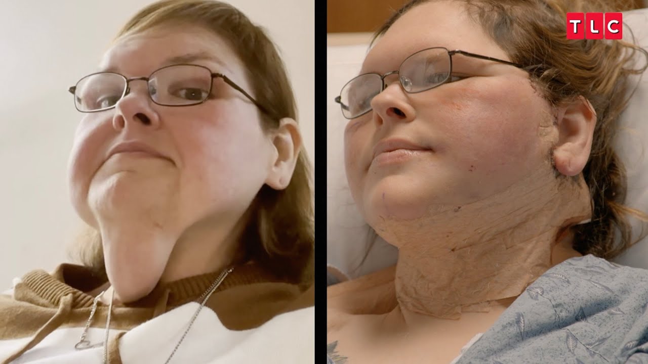 '1000-lb Sisters': Tammy's TRANSFORMATION After Skin Removal Surgery