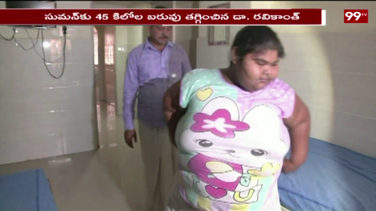 14 ఏళ్లకే 185 కేజీల బరువు | Suman Khatun lost 145kg Weight in 1 Month | Bariatric surgery | 99TV