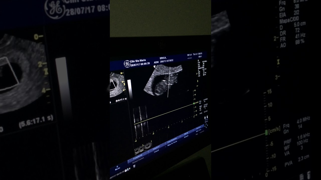 4 Semanas