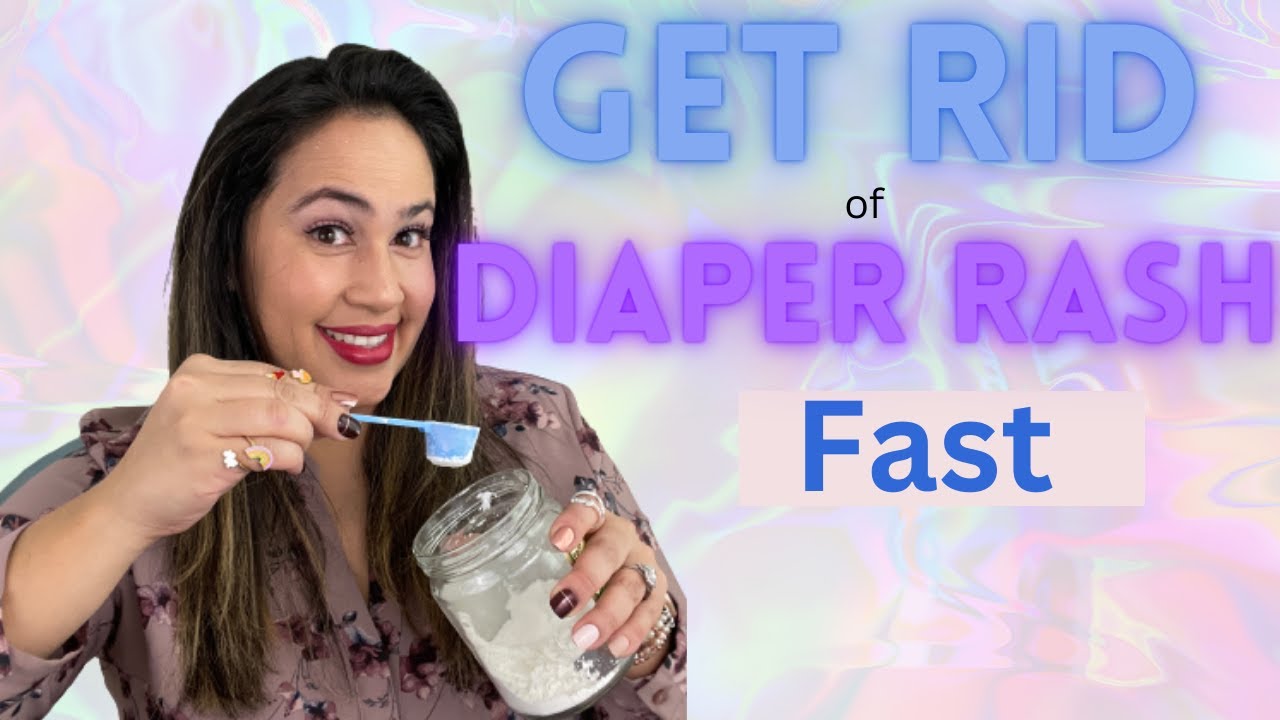 5 Home Remedies for Diaper Rash That Really Work// Natural Diaper Rash Remedies.