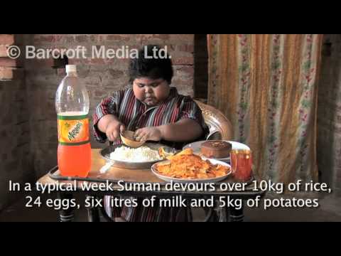 5 Year Old Child Weighs 75 Kilograms
