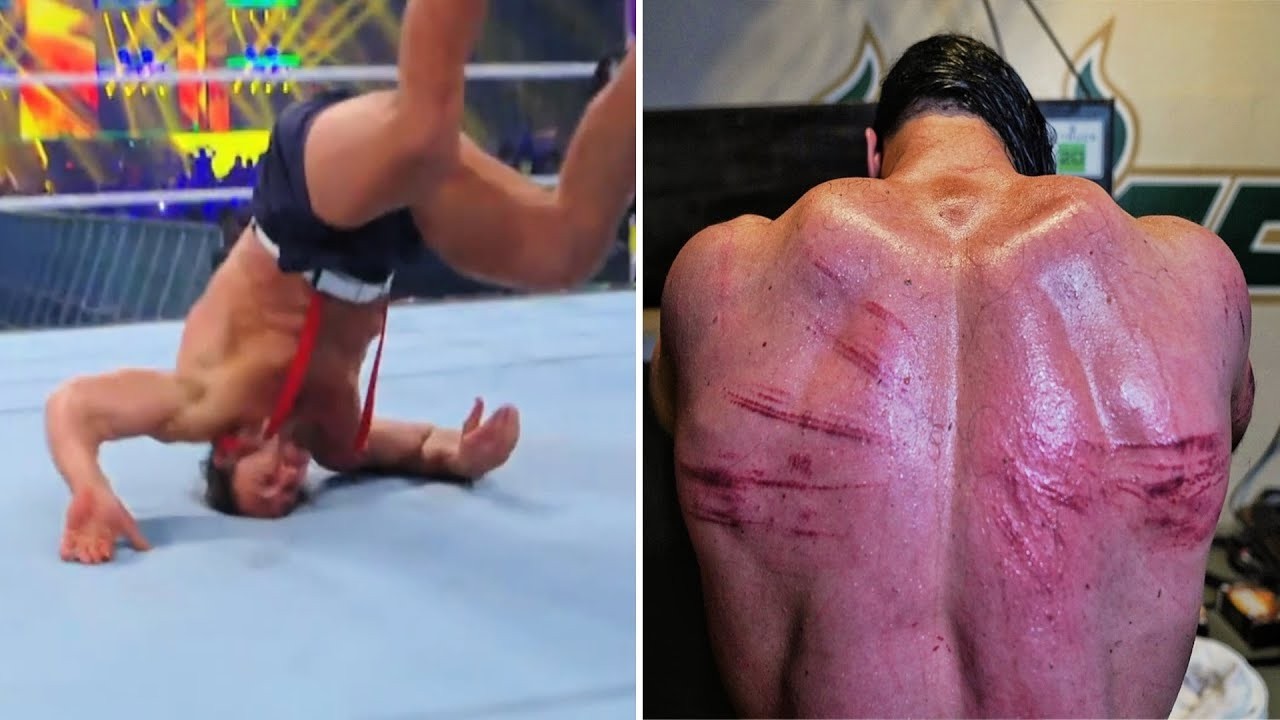 50 Minutes of the Worst WWE Injuries