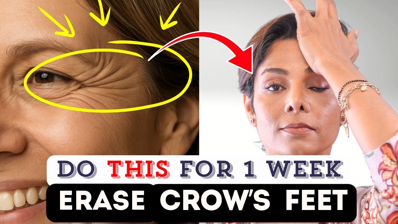 7-Day Face Yoga Challenge: Reduce Crow's Feet Around eyes Naturally Without Botox or Fillers!