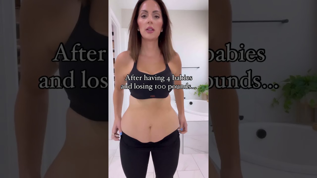 8 Week Post-Op Update