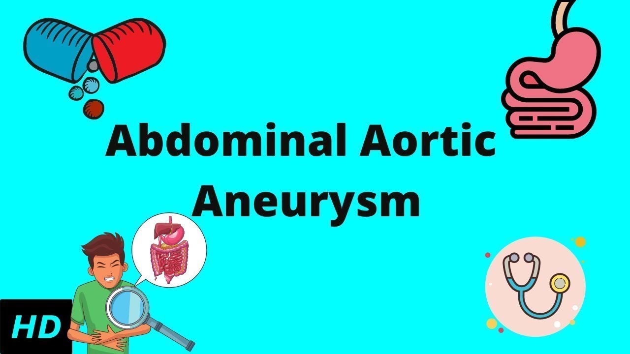 Abdominal Aortic Aneurysm, Causes, Signs and Symptoms, Diagnosis and Treatment.