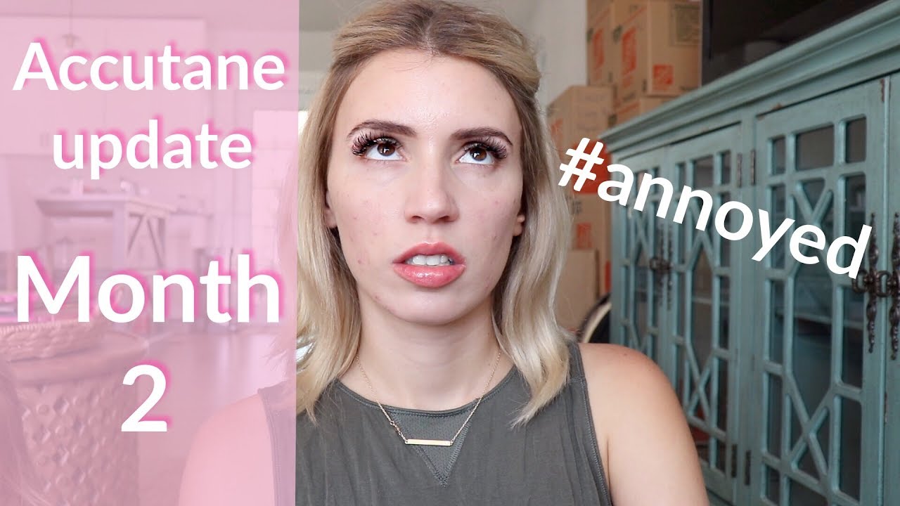 ACCUTANE UPDATE  | MONTH 2
