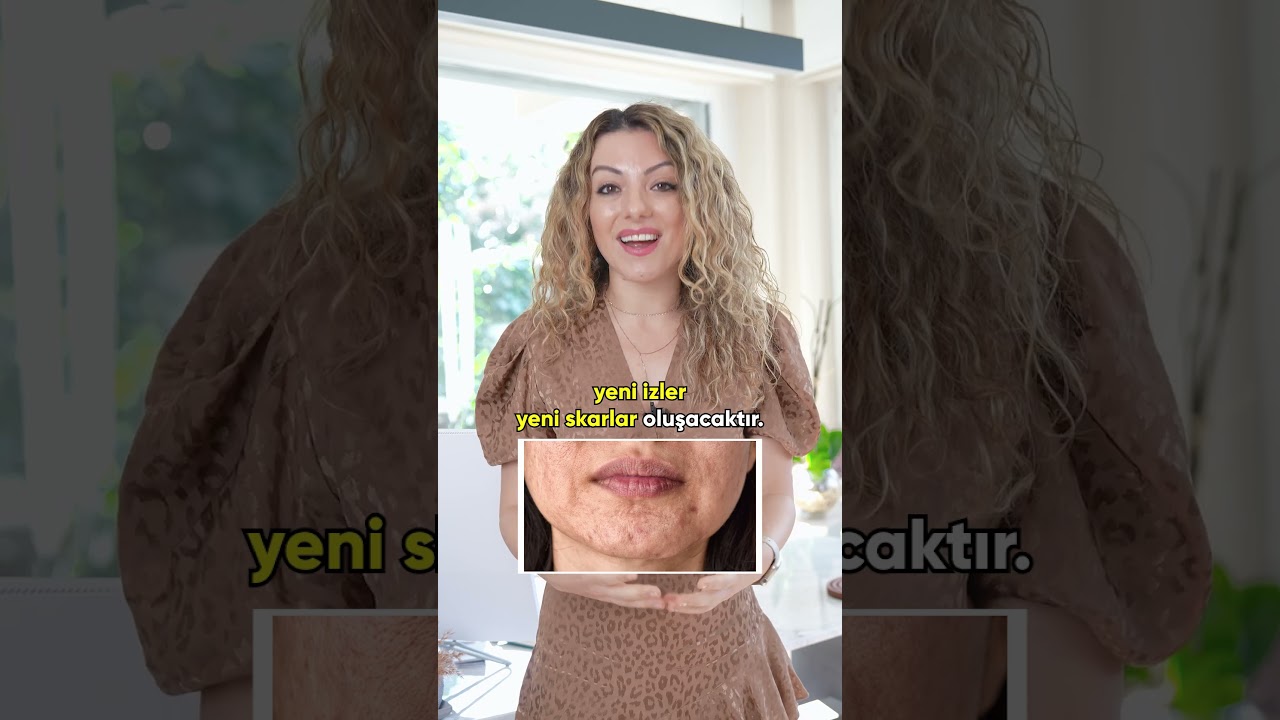 Akne Tedavisinde En Önemli Şey - Sivilcelerle Savaş!