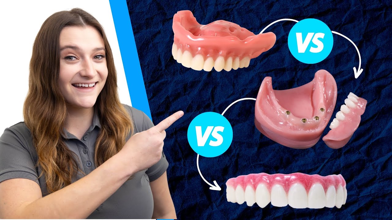 Alternative to Dentures: Comparing Dentures, Overdentures, All-on-4 and Permanent Teeth in 24-Hrs