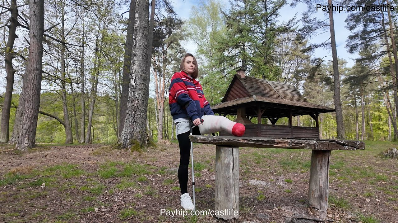 Amputee - casted stump relaxing by the lake with a girl