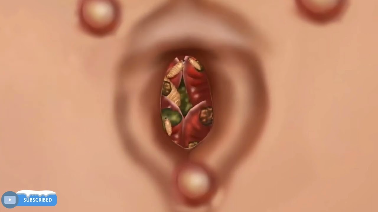 Amsr Cleaning navel worm #amsr #animation #satisfying #trending #viral #shortsfeed #ytshorts #short