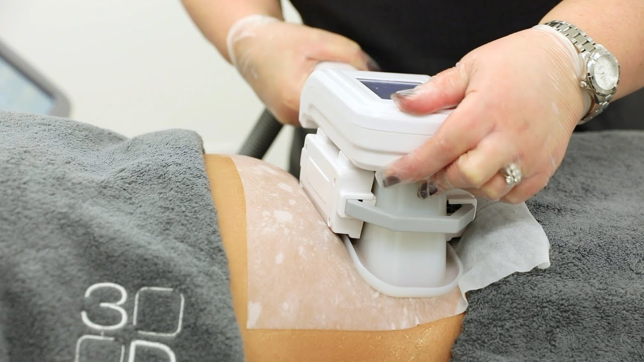 An introduction to 3D-lipo ultimatepro