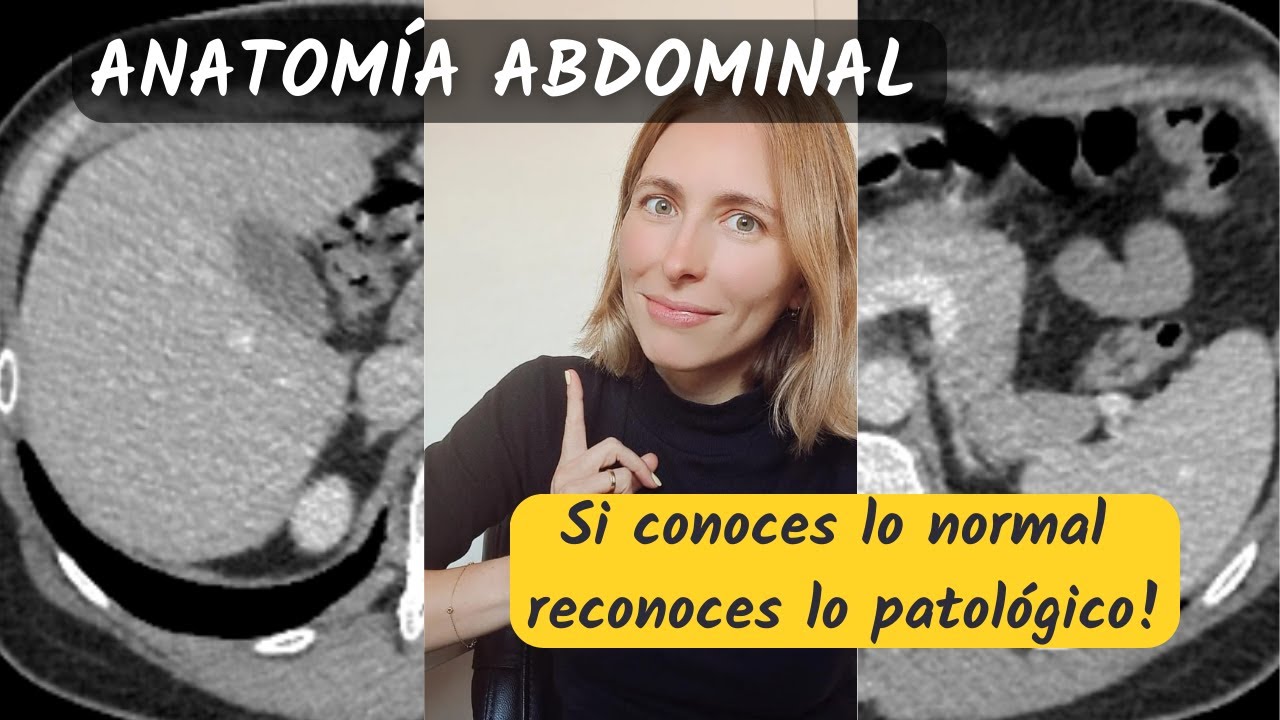 Anatomía abdominal por tomografía 😎 ¡Si conoces lo normal reconoces lo patológico! 💪
