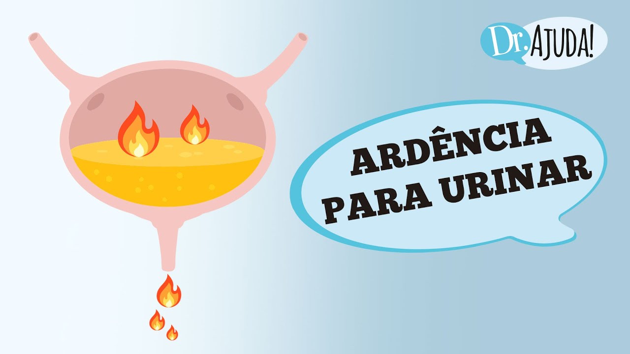 ARDÊNCIA PARA URINAR: QUAIS AS CAUSAS? O QUE VOCÊ NÃO PODE DEIXAR DE REPARAR?