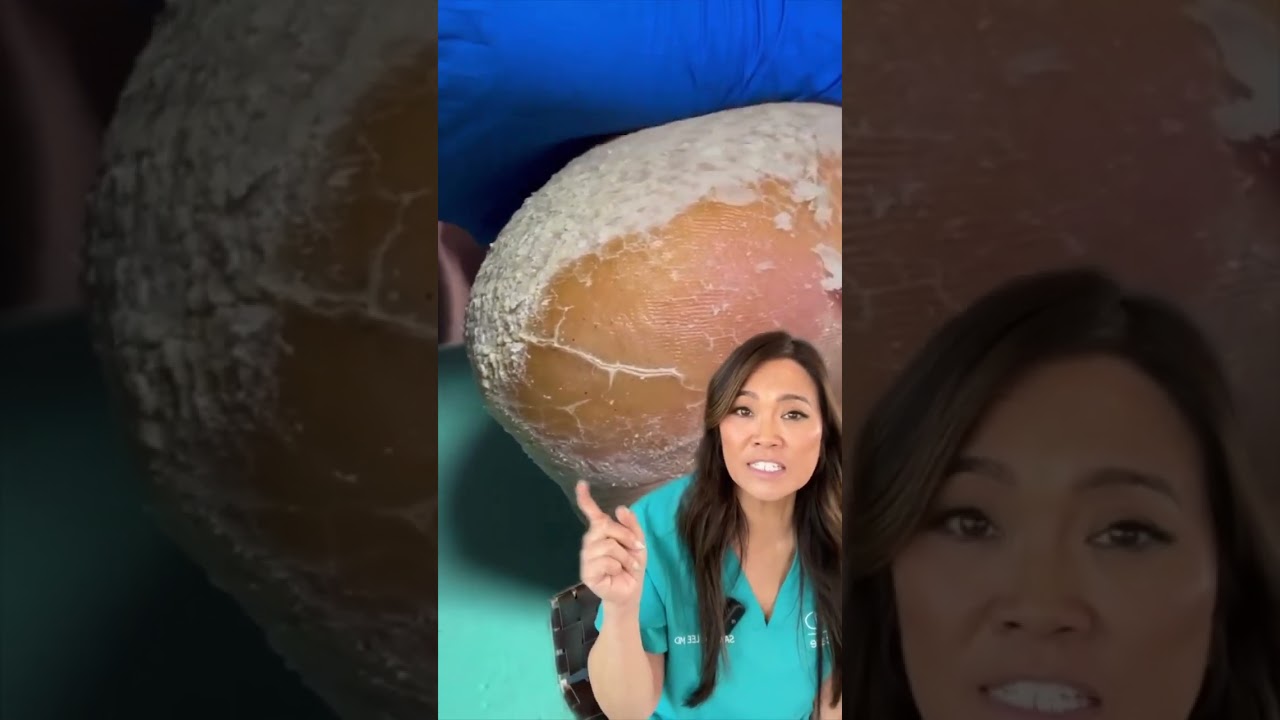 Are you carving a turkey or dry, cracked heels today 👀🦃