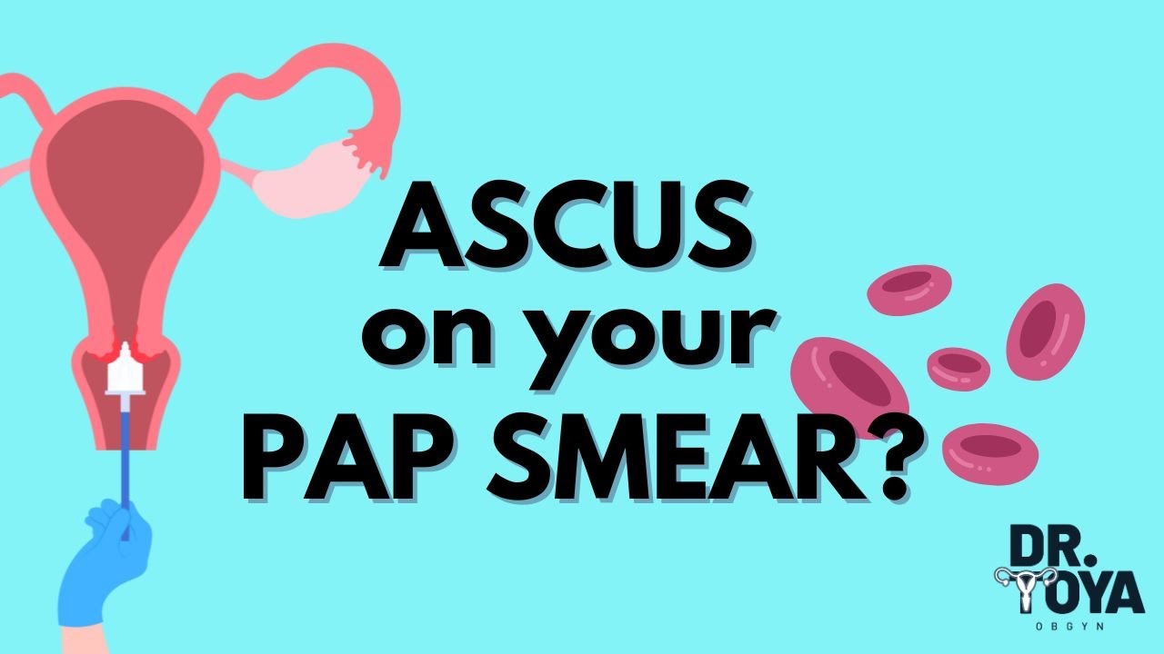 ASCUS on your PAP SMEAR?