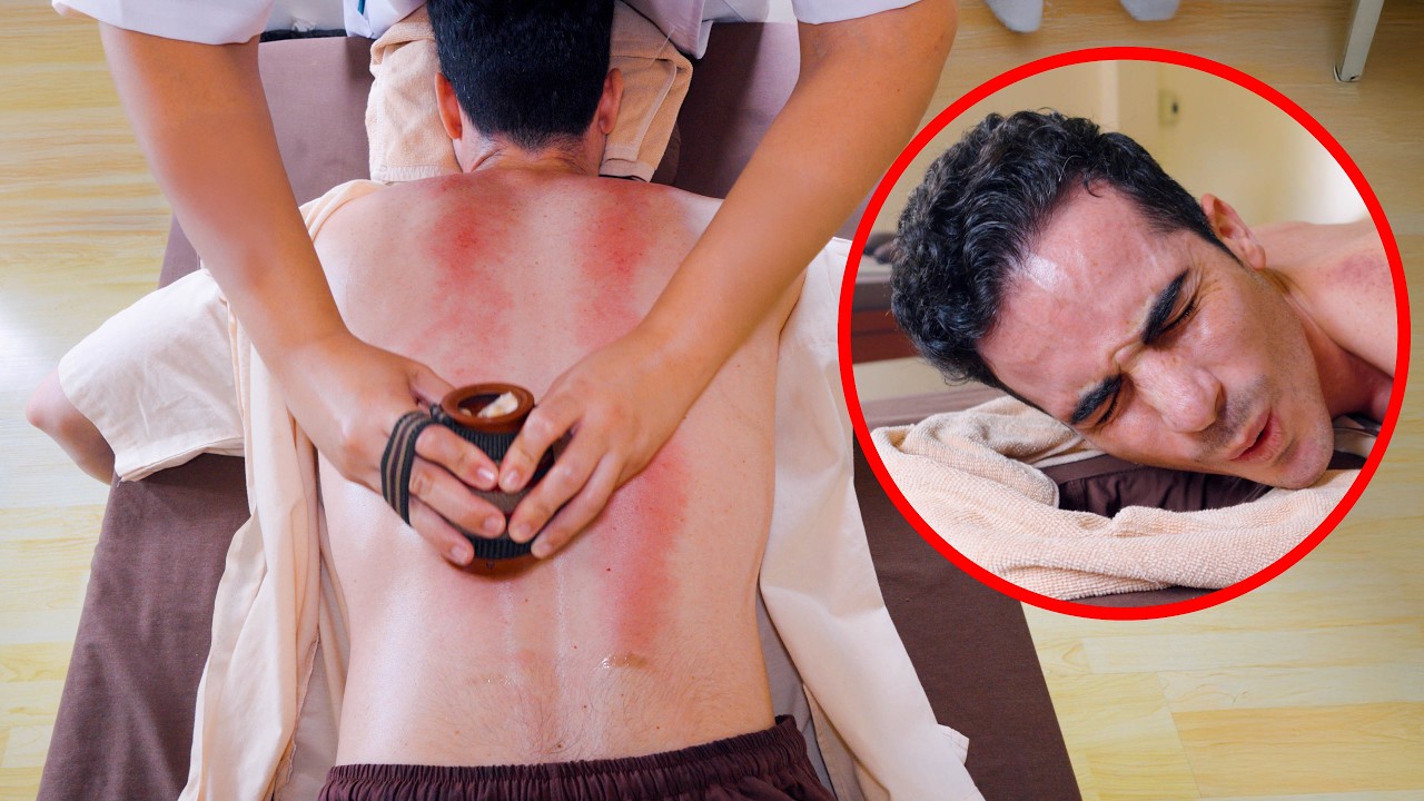ASMR: Amazing Chinese Pressure Point Guasha Moxibustion Back Massage with Eye Spa