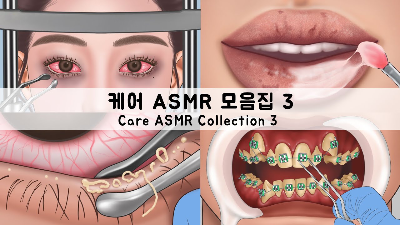 ASMR CARE ANIMATION COLLECTION 3 | Eyelid Sebum, Braces, Shaving, Skin Care, Waxing