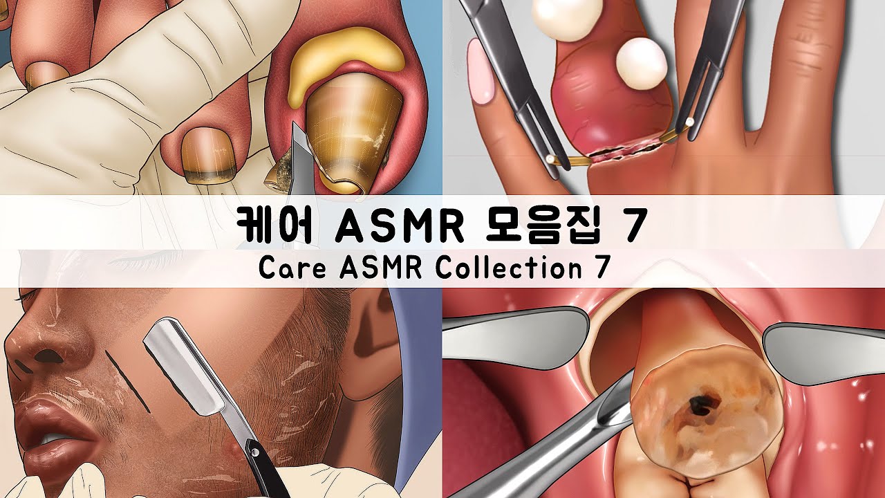 ASMR CARE ANIMATION COLLECTION7 | Ingrown toenails,head lice,cavities