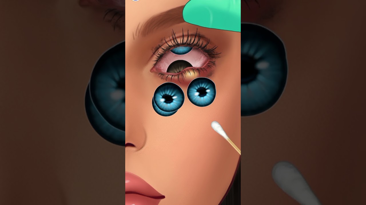ASMR remove 6 layers of contact lenses cause of eye infection #asmr  #asmranimation  #asmrvideo