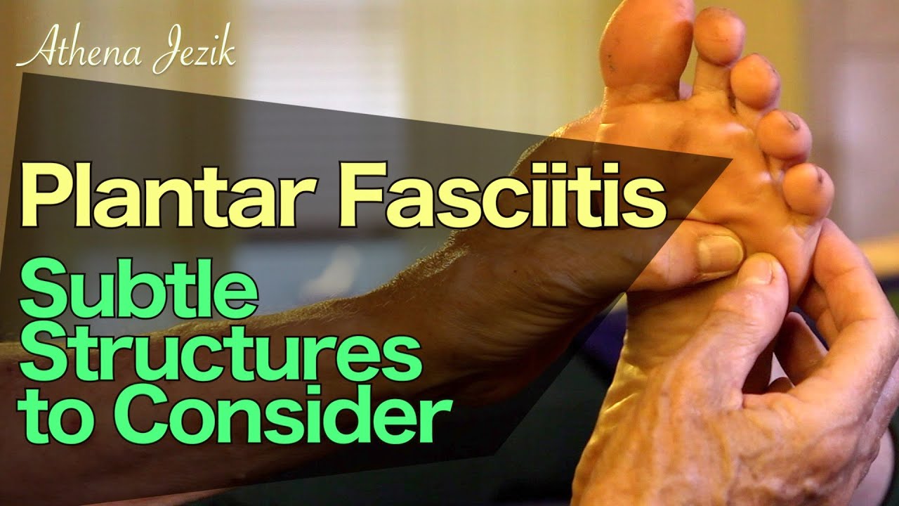 Athena Jezik - Plantar Fasciitis - Subtle Structures to Consider