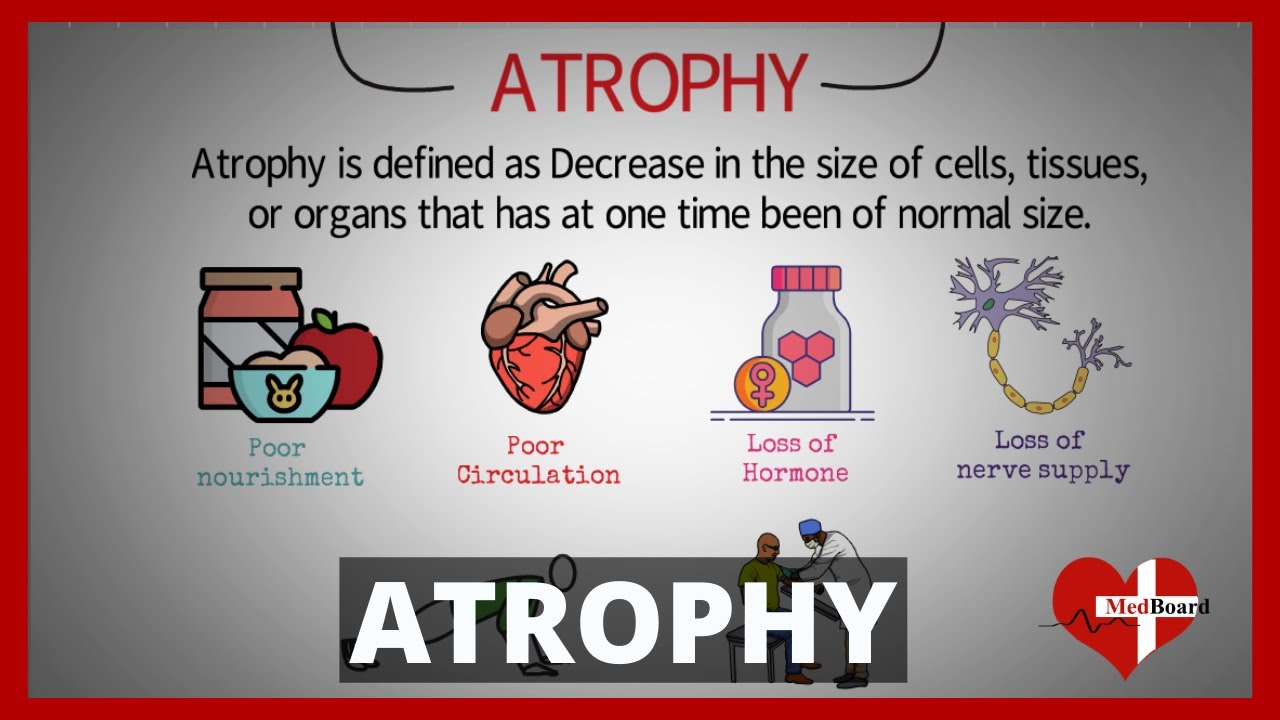 Atrophy -Types and Causes (Made Easy)  | What is atrophy? |