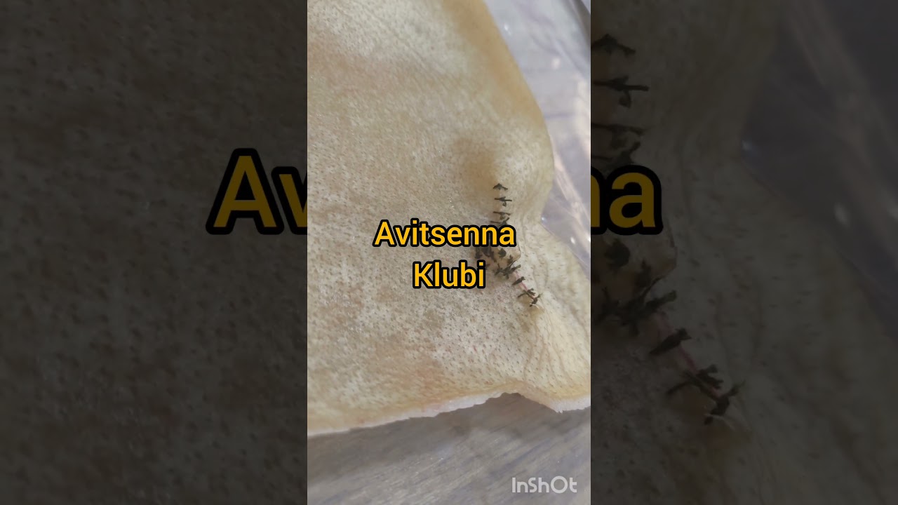 Avitsenna klubi, emchak alveolyar kompleksi