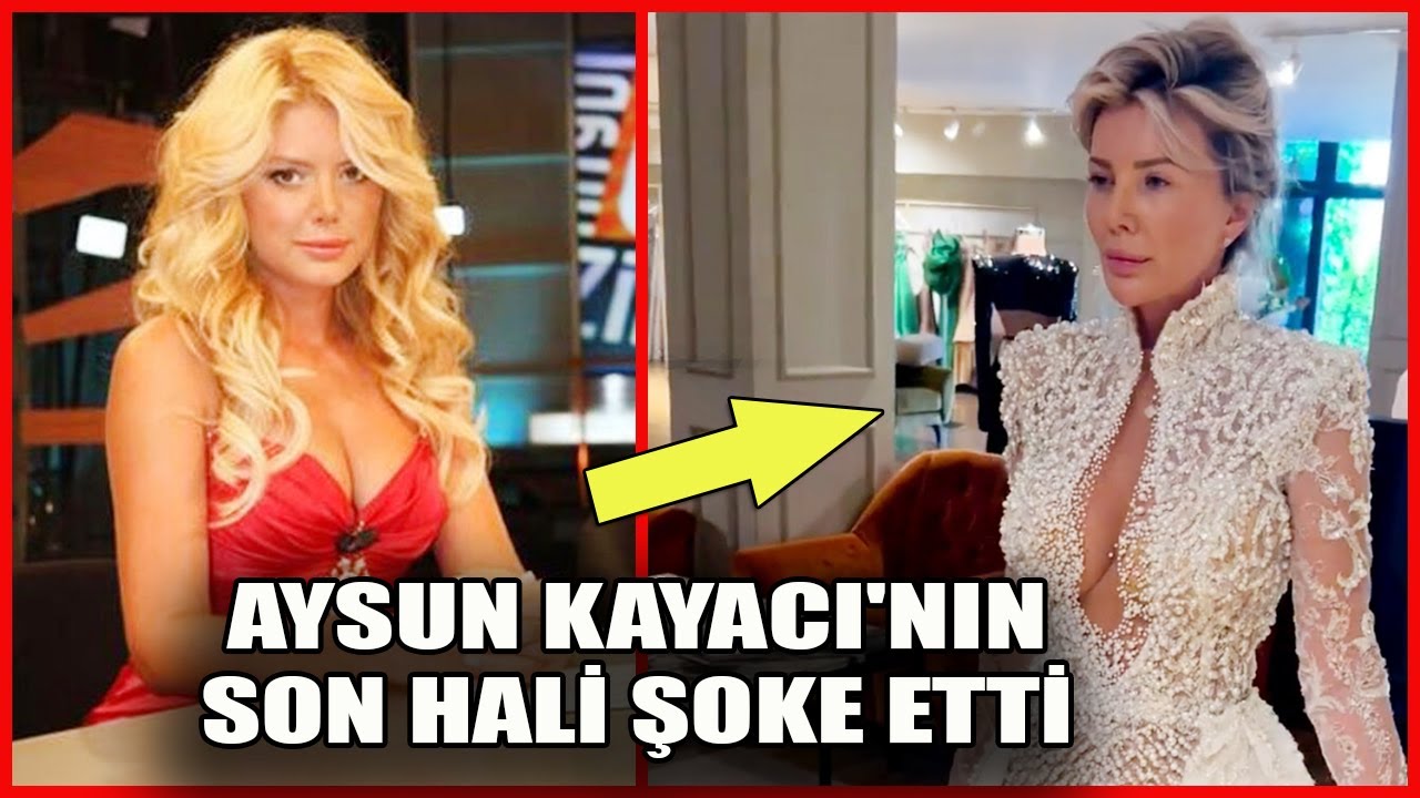 Aysun Kayacı'nın Son Hâli Şaşırttı! - İşte Aysun Kayacı'nın Büyük Değişimi