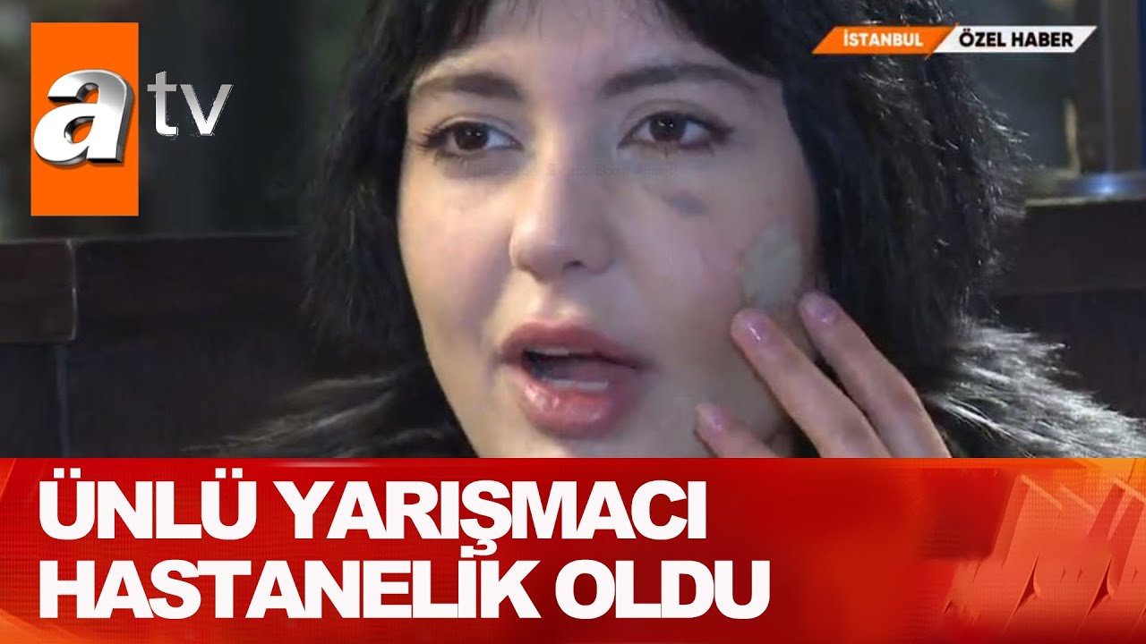 Bahar Candan'ın yüzü parçalandı - Atv Haber 30 Mart 2021