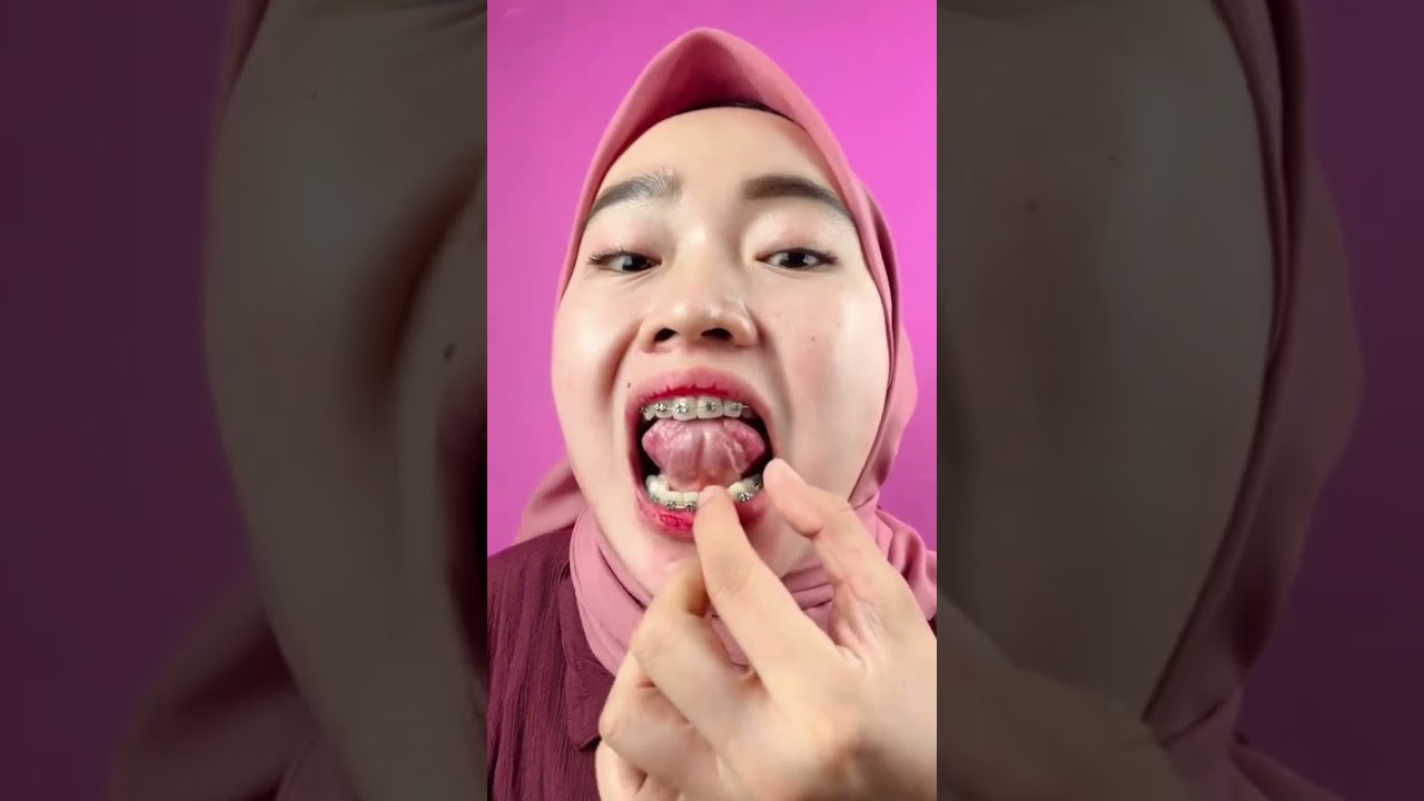 Baru tau ternyata di bawah lidah kita ada atena ?!!😱😫