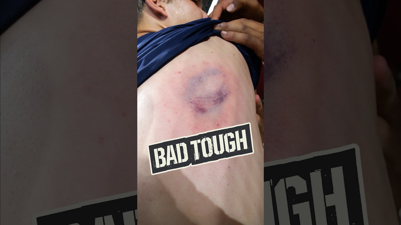 BEANED by 98 mph…TWICE IN ONE AT BAT?! 😱🤯