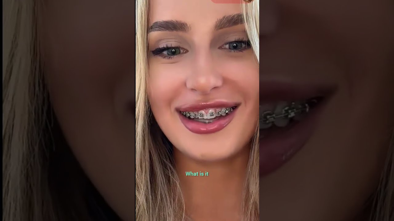 🌹🍀Beautiful kissing girl#periscope#vlogs