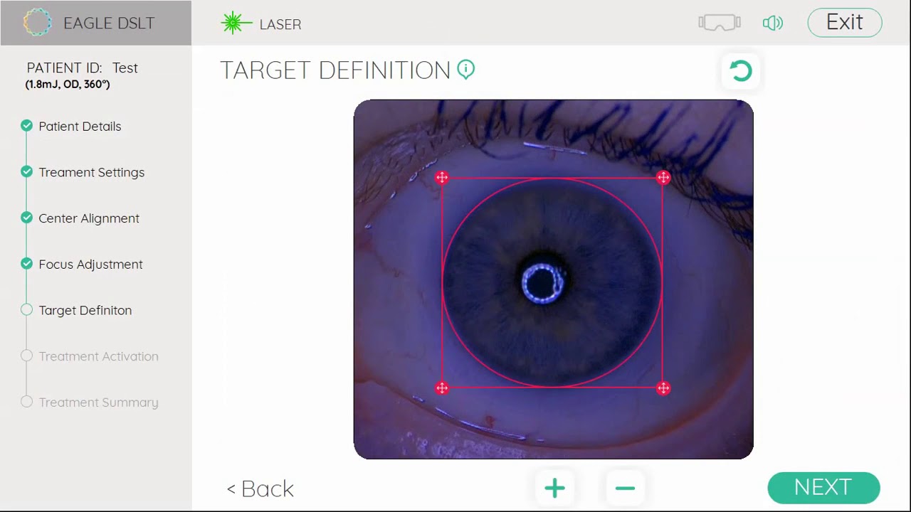 BELKIN Vision DSLT Procedure live