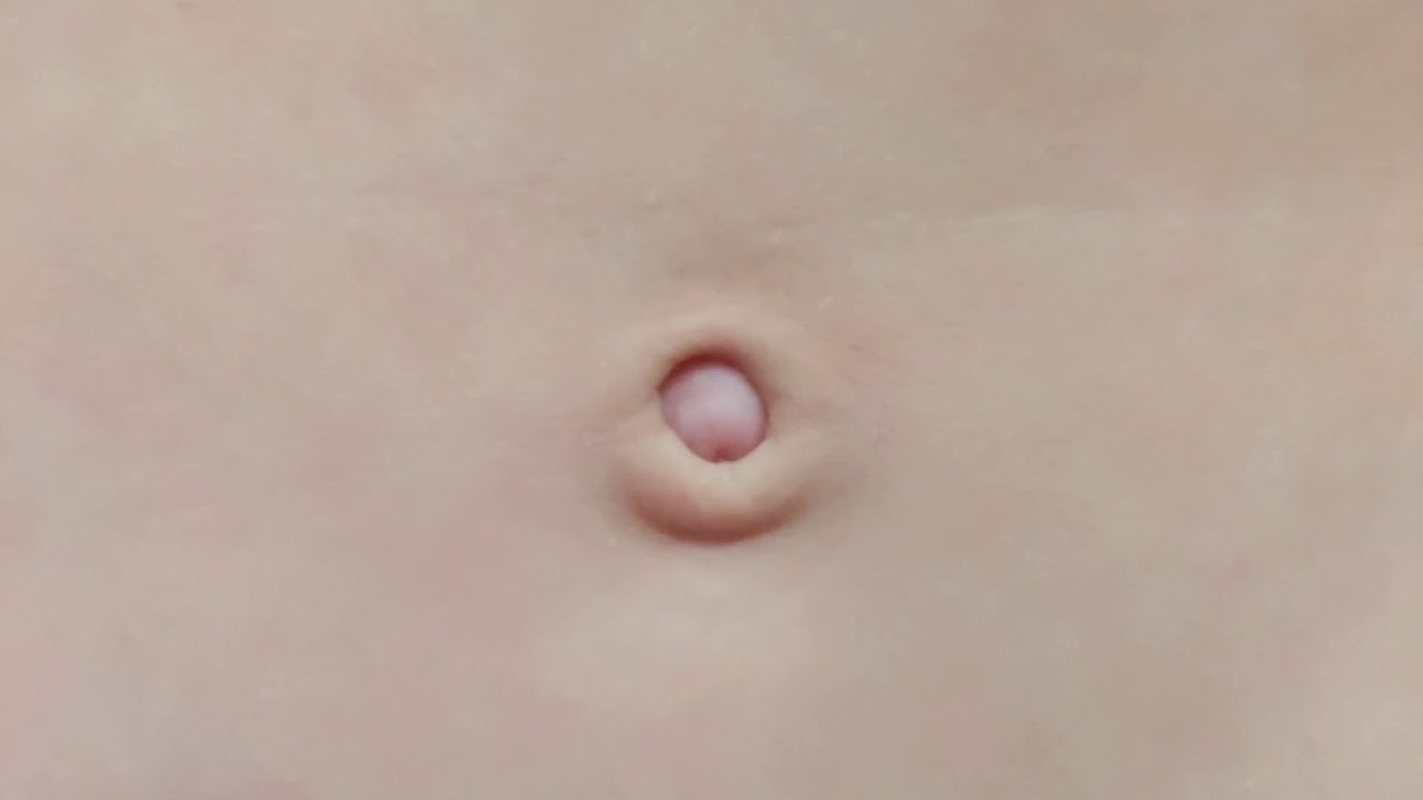 Belly button