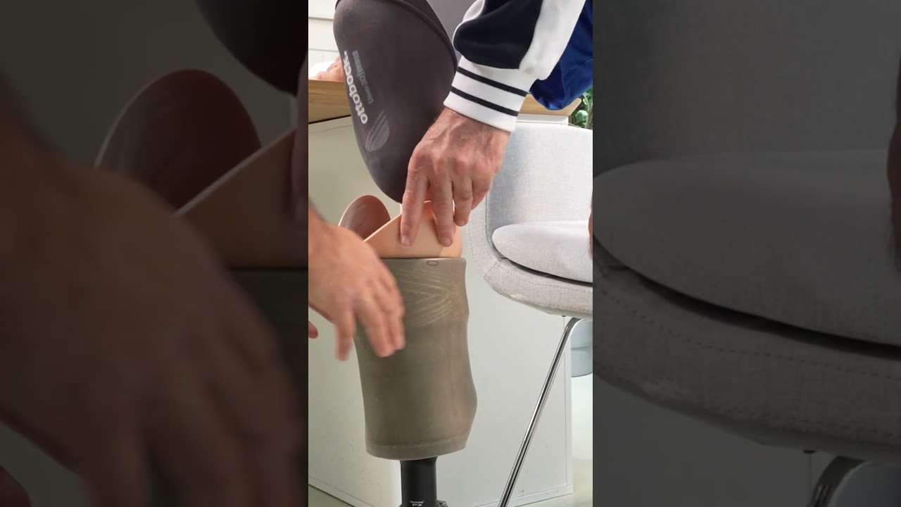 Below-knee prosthesis with active vacuum system