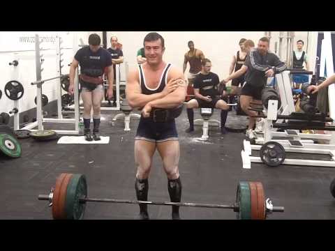Biceps Tendon Tear -- Deadlift