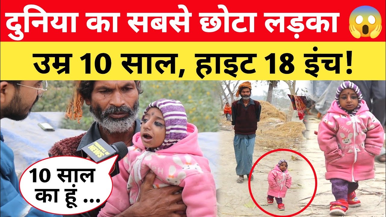 Bihar का सबसे छोटा लड़का, उम्र 10 साल है लेकिन हाइट 18 इंच 😱 देख लोग हुए हैरान! #viralvideo
