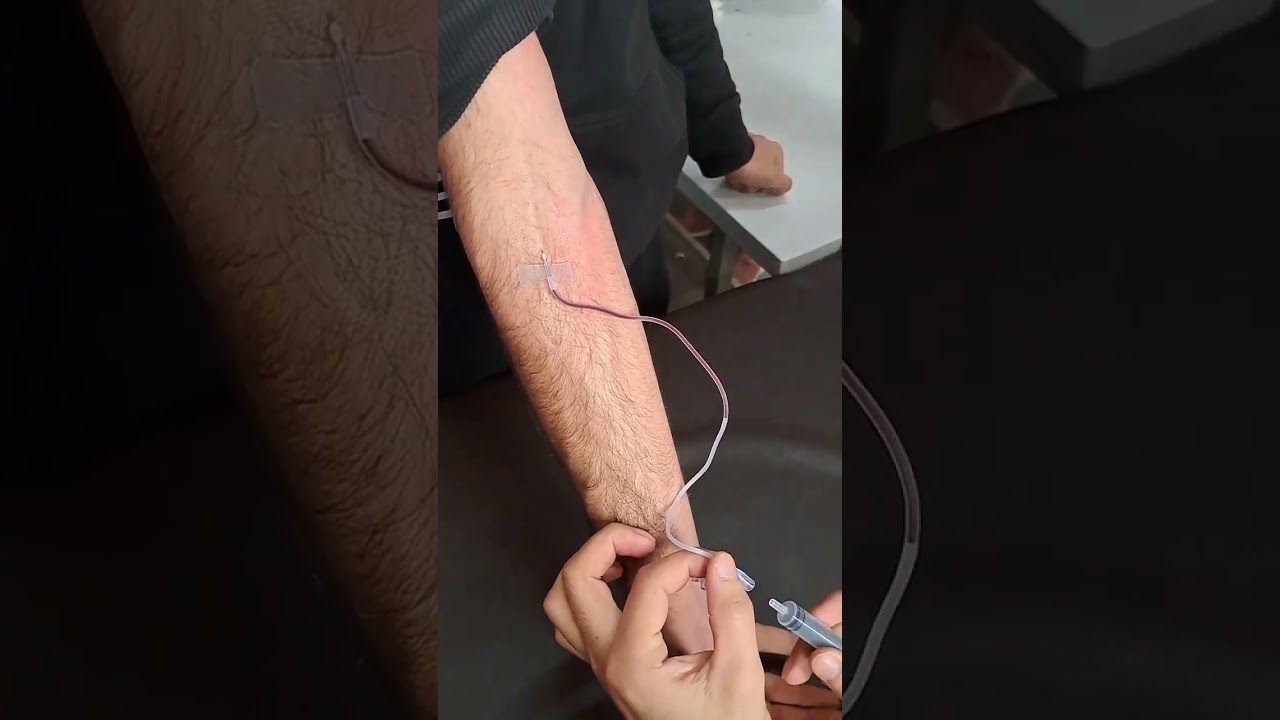 Blood collection by butterfly needle #hospital #medicallaboratory #microscope