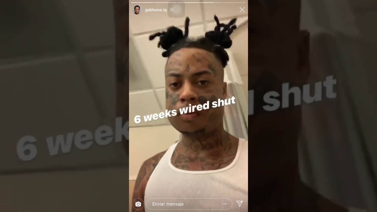 Boonk gang after the fight