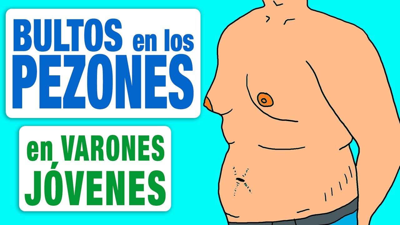 Bultos en los Pezones en el Varón Adolescente - Piérdales el miedo