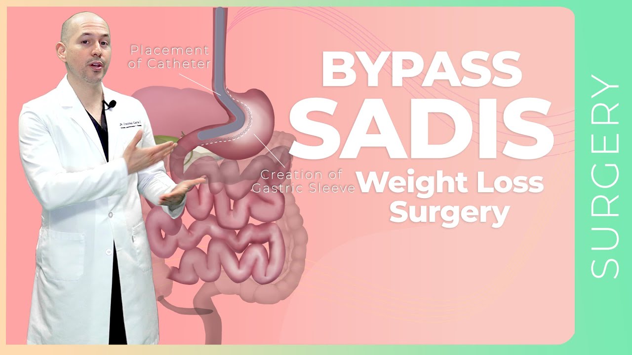 BYPASS SADIS What is it? How it works? | Surgery