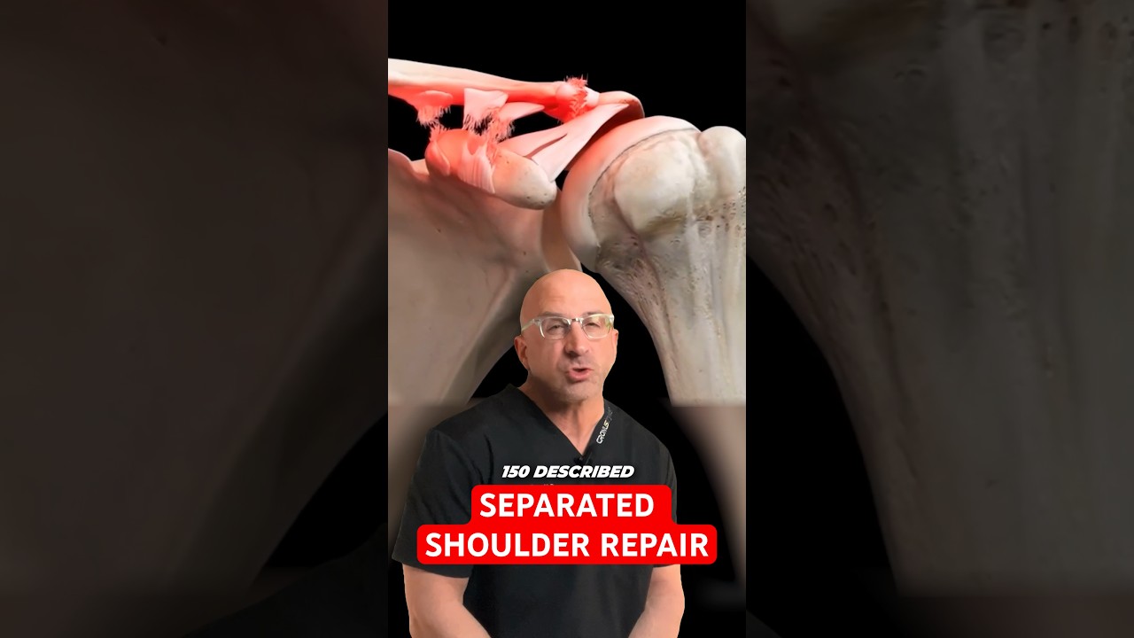 Can Surgery Fix a Separated Shoulder⁉️ #shorts