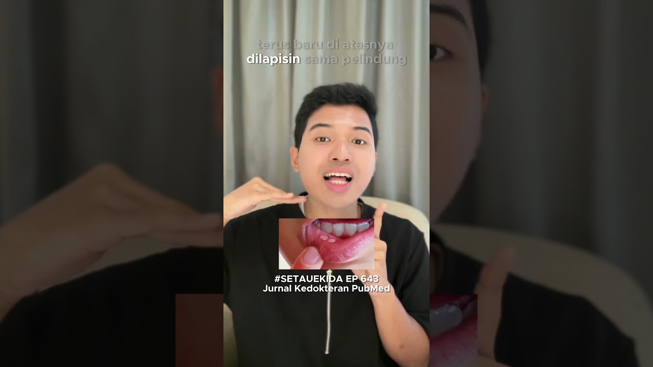 cara pengobatan sariawan #youtubehealth #setauekida