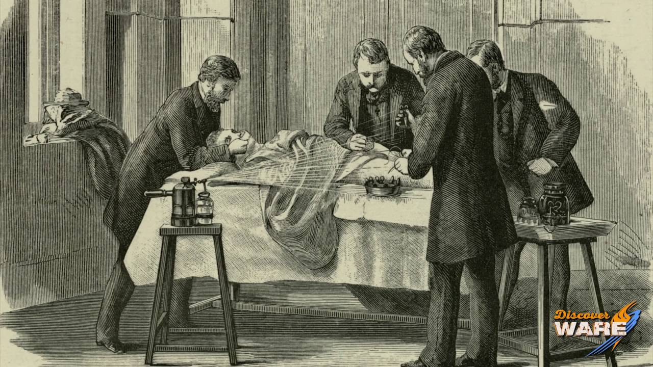 Carbolic Steam Sprayer - Steam Culture