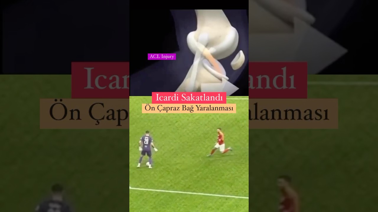 İcardi Sakatlandı.( Tottenham Maçı )