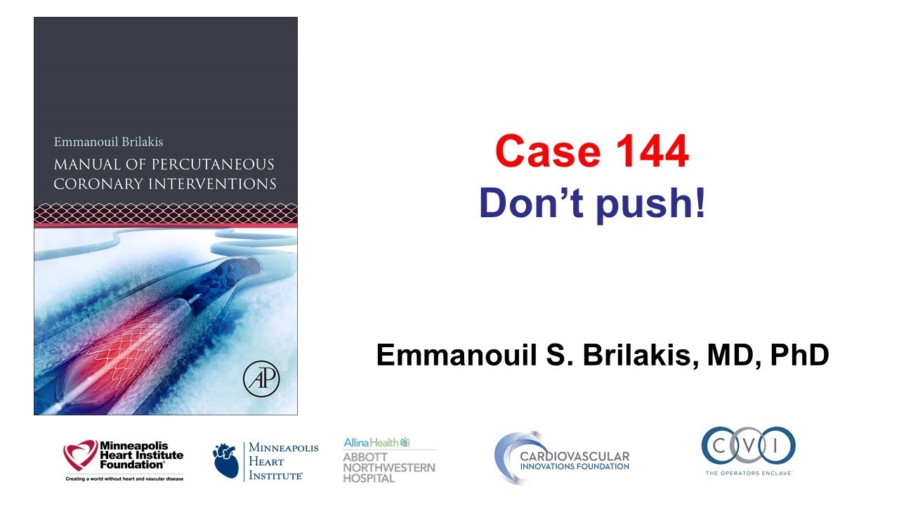Case 144: PCI Manual - Don't Push!!