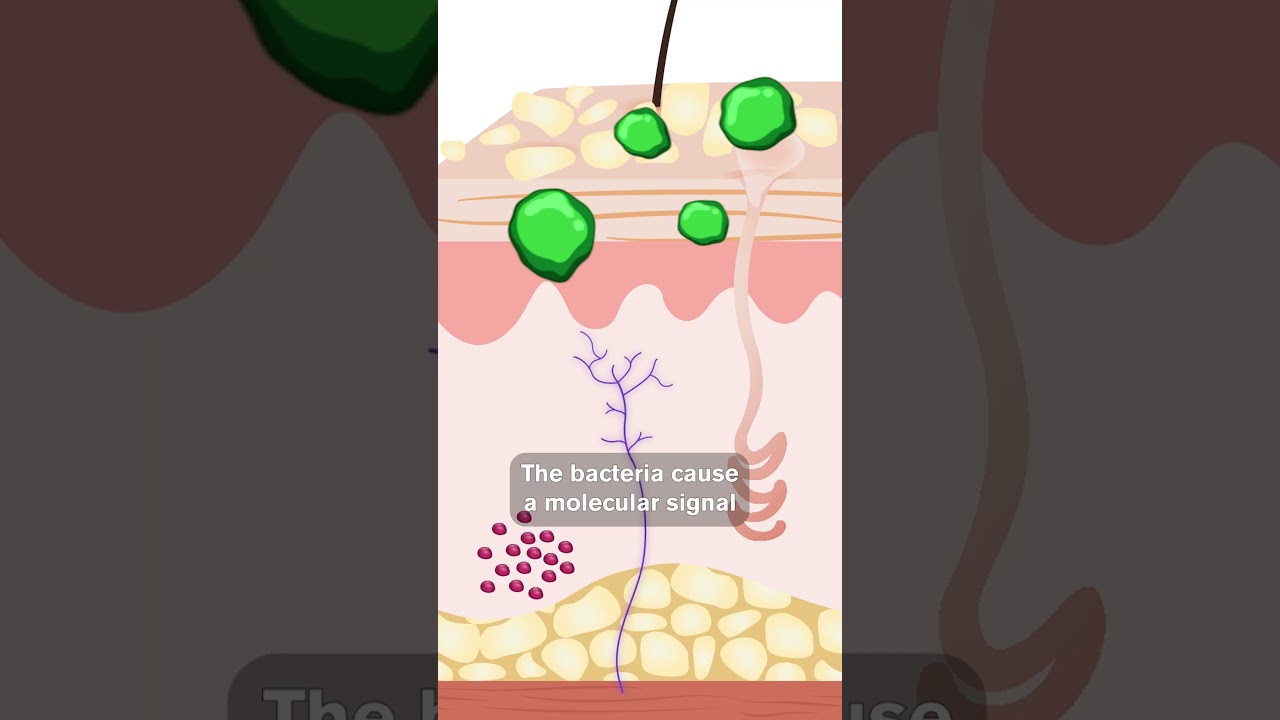 Cause of Chronic Itching Revealed by Harvard Researchers